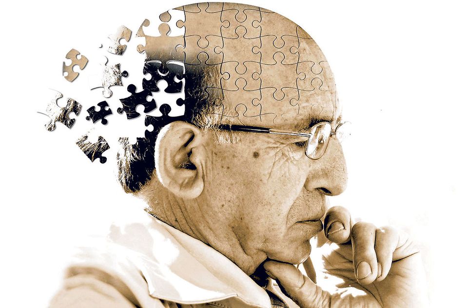 Jaga Otak Tetap Sehat Agar Menurunkan Risiko Alzheimer